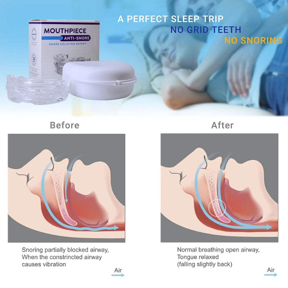 Anti-Snoring Mouth Guard Improve