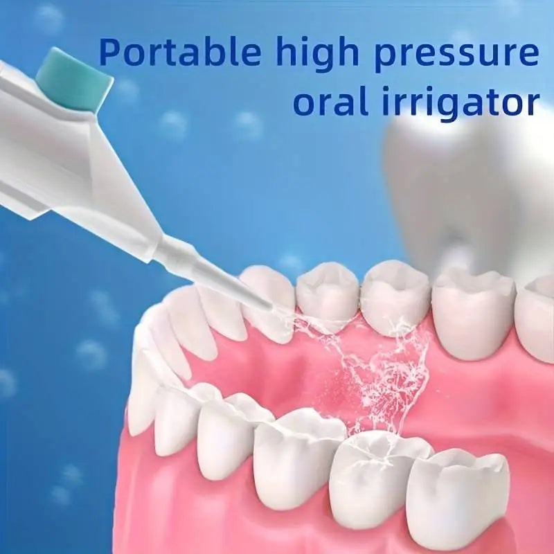 High-Pressure Dental Water Floss